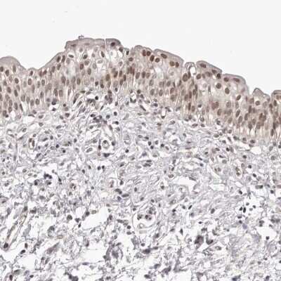 Immunohistochemistry-Paraffin: RNF2 Antibody [NBP1-88712] - Staining of human urinary bladder shows nuclear positivity in urothelial cells.