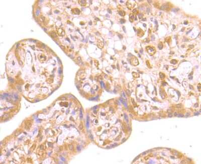 Immunohistochemistry-Paraffin: RNF2 Antibody (JB38-41) [NBP2-75647] - Analysis of paraffin-embedded human placenta tissue using anti-RING2 antibody. Counter stained with hematoxylin.