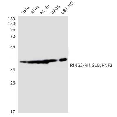 Western Blot: RNF2 Antibody (S04-2B3) [NBP3-14971] - Western blot detection of RNF2 in Hela, A549, HL-60, U2OS, U87-MG cell lysates using RNF2 Rabbit mAb (1:1000 diluted). Observed band size: 38kDa.