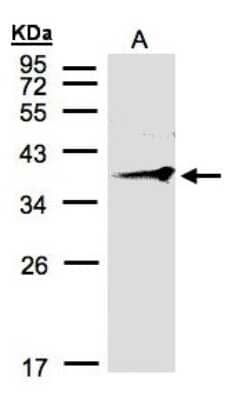 Western Blot: RNF2 Antibody [NBP1-31048] - Sample(30 ug of whole cell lysate)A:MOLT4 12% SDS PAGE, antibody diluted at 1:500.