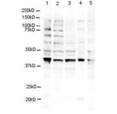 Western Blot: RNF2 Antibody [NBP1-77826] - Detection of a 38 kDa band corresponding to human RING1B in 3T3 (lane 1), U937 (lane 2), Jurkat (lane 3), mouse brain (lane 4) and CHO-K1 (lane 5) cell lysates. Approximately 20 ug of lysate was run on a SDS-PAGE and transferred onto nitrocellulose followed by reaction with a 1:500 dilution of anti-RING1B antibody incubated at room temperature. Signal was detected using standard techniques.