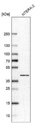 Western Blot: RNF2 Antibody [NBP1-88712] - Analysis in human cell line NTERA-2.