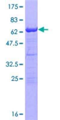 SDS-PAGE Recombinant Human RNF2 GST (N-Term) Protein