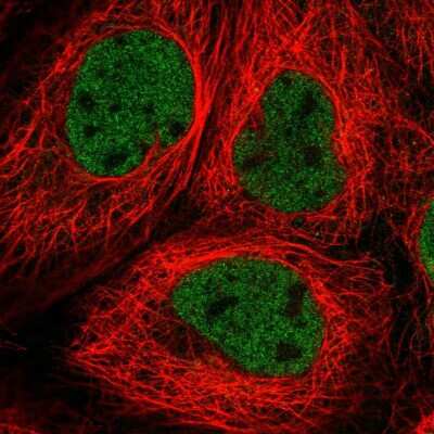 Immunocytochemistry/Immunofluorescence: RNF20 Antibody [NBP2-54995] - Staining of human cell line A-431 shows localization to nucleoplasm.