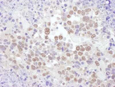 Immunohistochemistry-Paraffin: RNF20 Antibody [NB100-2243] - Sample: FFPE section of mouse plasmacytoma. Antibody: Affinity purified rabbit anti- RNF20 used at a dilution of 1:1,000 (1ug/ml). Detection: DAB