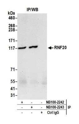 <b>Independent Antibodies Validation. </b>Immunoprecipitation: RNF20 Antibody [NB100-2243] - Detection of human RNF20 by western blot of immunoprecipitates. Samples: Whole cell lysate (0.5 or 1.0 mg per IP reaction; 20% of IP loaded) from HeLa cells prepared using NETN lysis buffer. Antibodies: Affinity purified rabbit anti-RNF20 antibody NB100-2243 used for IP at 6 ug per reaction. RNF20 was also immunoprecipitated by rabbit anti-RNF20 antibody NB100-2242. For blotting immunoprecipitated RNF20, NB100-2243 was used at 1 ug/ml. Detection: Chemiluminescence with an exposure time of 30 seconds.