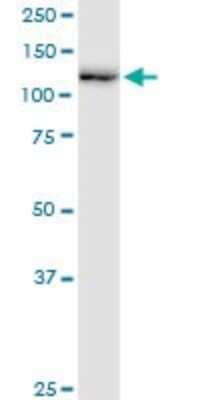 Western Blot: RNF20 Antibody [H00056254-B01P] - Analysis of RNF20 expression in HeLa.