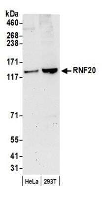 Western Blot: RNF20 Antibody [NB100-2243] - Detection of Human RNF20 by Western Blot. Samples: Whole cell lysate (50 ug) from HeLa and 293T cells prepared using NETN lysis buffer. Antibody: Affinity purified rabbit anti-RNF20 antibody NB100-2243 used for WB at 0.1 ug/ml. Detection: Chemiluminescence with an exposure time of 30 seconds.