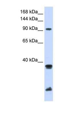 Western Blot: RNF20 Antibody [NBP1-52945] - MCF-7 whole cell lysates, concentration 0.2-1 ug/ml.