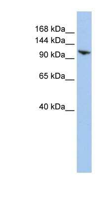 Western Blot: RNF20 Antibody [NBP1-52985] - HepG2 cell lysate, concentration 0.2-1 ug/ml.