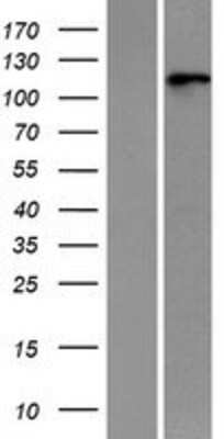 Western Blot: RNF20 Overexpression Lysate (Adult Normal) [NBP2-06703] Left-Empty vector transfected control cell lysate (HEK293 cell lysate); Right -Over-expression Lysate for RNF20.