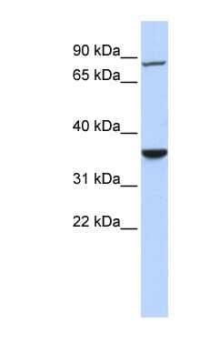 Western Blot: RNF207 Antibody [NBP1-54794] - Jurkat cell lysate, concentration 0.2-1 ug/ml.