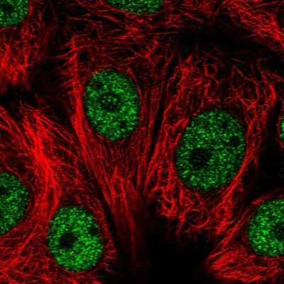 Immunocytochemistry/Immunofluorescence: RNF208 Antibody [NBP1-90501] - Staining of human cell line MCF7 shows localization to nucleoplasm. Antibody staining is shown in green. 