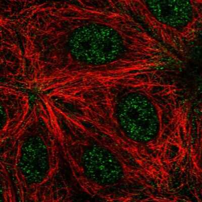 Immunocytochemistry/Immunofluorescence: RNF208 Antibody [NBP1-90502] - Immunofluorescent staining of human cell line MCF7 shows localization to nucleoplasm.