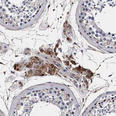 Immunohistochemistry: RNF208 Antibody [NBP1-90502] - Staining of human testis shows strong cytoplasmic positivity in Leydig cells.