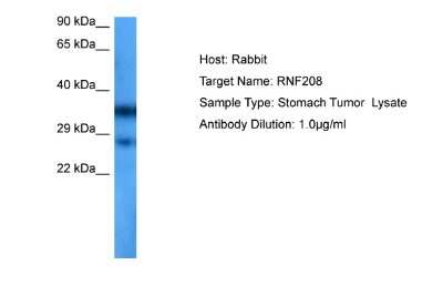 Western Blot: RNF208 Antibody [NBP2-85647] - Host: Rabbit. Target Name: RNF208. Sample Tissue: Human Stomach Tumor. Antibody Dilution: 1.0ug/ml