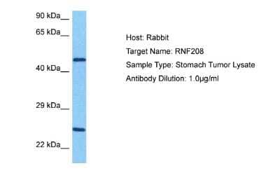 Western Blot: RNF208 Antibody [NBP2-85648] - Host: Rabbit. Target Name: RNF208. Sample Tissue: Human Stomach Tumor lysates. Antibody Dilution: 1ug/ml