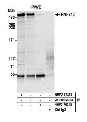 RNF213 Antibody [NBP2-76354] - Detection of human RNF213 by western blot of immunoprecipitates. Samples: Whole cell lysate (1.0 mg per IP reaction; 20% of IP loaded) from Jurkat cells prepared using NETN lysis buffer. Antibodies: Affinity purified rabbit anti-RNF213 antibody NBP2-76354 used for IP at 15 ul per reaction. RNF213 was also immunoprecipitated by another rabbit anti-RNF213 antibody and NBP2-76355. For blotting immunoprecipitated RNF213, NBP2-76354 was used at 1:40. Detection: Chemiluminescence with an exposure time of 10 seconds.
