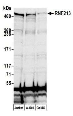 Western Blot: RNF213 Antibody [NBP2-76355] - Samples: Whole cell lysate (50 ug) from Jurkat, A-549, and GaMG cells prepared using NETN lysis buffer. Antibody: Affinity purified rabbit anti-RNF213 antibody NBP2-76355 used for WB at 1:1000. Detection: Chemiluminescence with an exposure time of 10 seconds.