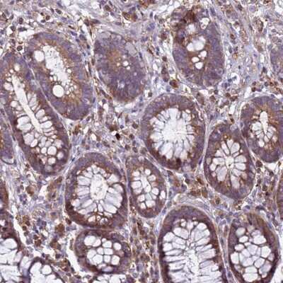 Immunohistochemistry: RNF215 Antibody [NBP2-68609] - Immunohistochemical staining of human rectum shows moderate cytoplasmic positivity in glandular cells.