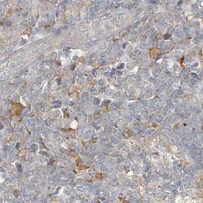 Immunohistochemistry-Paraffin: RNF219 Antibody [NBP1-88401] - Staining of human lymph node.
