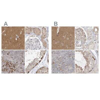 <b>Independent Antibodies Validation. </b>Immunohistochemistry-Paraffin: RNF219 Antibody [NBP2-33979] - Staining of human cerebral cortex, kidney, lymph node and testis using Anti-RNF219 antibody NBP2-33979 (A) shows similar protein distribution across tissues to independent antibody NBP1-88401 (B).