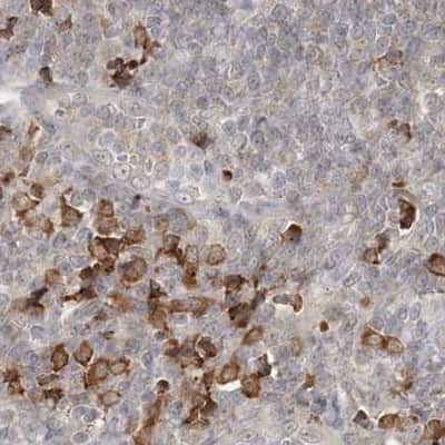 Immunohistochemistry-Paraffin: RNF219 Antibody [NBP2-33979] - Staining of human lymph node.