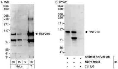 Western Blot: RNF219 Antibody [NBP1-40358] - Whole cell lysate from HeLa (5, 15 and 50 mcg for WB; 1 mg for IP, 20% of IP loaded) and 293T (T; 50 mcg) cells.   Affinity purified rabbit anti-RNF219 antibody used for WB at 0.04 mcg/ml (A) and 1 mcg/ml (B) and used for IP at 10 mcg/mg lysate.  RNF219 was also immunoprecipitated by another rabbit anti-RNF219 antibody  which recognizes an upstream epitope.