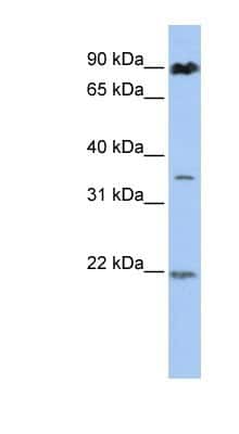 Western Blot: RNF219 Antibody [NBP1-55064] - Titration: 0.2-1 ug/ml, Positive Control: 721_B cell lysate.