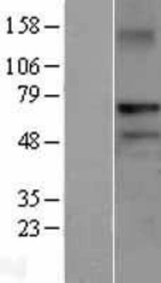 Western Blot: RNF220 Overexpression Lysate (Adult Normal) [NBL1-15446] Left-Empty vector transfected control cell lysate (HEK293 cell lysate); Right -Over-expression Lysate for RNF220.