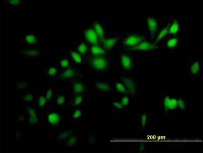 Immunocytochemistry/Immunofluorescence: RNF23 Antibody [H00056658-B02P] - Analysis of purified antibody to TRIM39 on HeLa cell. (antibody concentration 10 ug/ml)