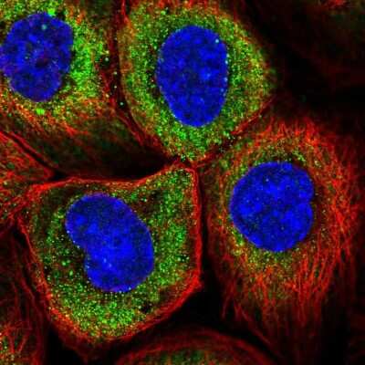 Immunocytochemistry/Immunofluorescence: RNF23 Antibody [NBP2-33605] - Staining of human cell line A-431 shows localization to cytosol.