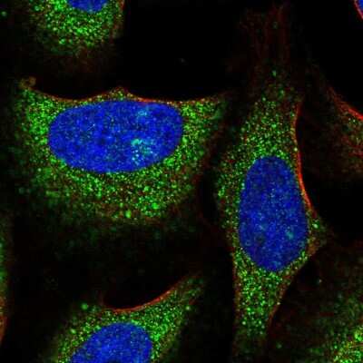 Immunocytochemistry/Immunofluorescence: RNF23 Antibody [NBP2-56934] - Staining of human cell line U-2 OS shows localization to cytosol.