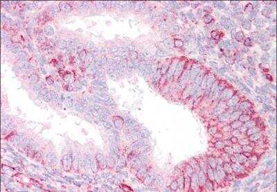 Immunohistochemistry-Paraffin: RNF23 Antibody [NB100-1187] -  staining of paraffin embedded Human Uterus. Steamed antigen retrieval with citrate buffer pH 6, AP-staining.