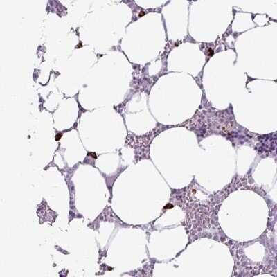 Immunohistochemistry-Paraffin: RNF23 Antibody [NBP2-33605] - Staining of human bone marrow shows strong cytoplasmic positivity in subset of hematopoietic cells.