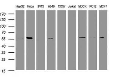 Western Blot: RNF23 Antibody (OTI2A6) - Azide and BSA Free [NBP2-73926] - Analysis of extracts (35ug) from 9 different cell lines by using TRIM39 monoclonal antibody (HepG2: human; HeLa: human; SVT2: mouse; A549: human; COS7: monkey; Jurkat: human; MDCK: canine; PC12: rat; MCF7: human). Dilution: 1:2000