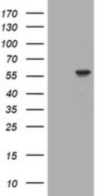 Western Blot: RNF23 Antibody (OTI2A6) - Azide and BSA Free [NBP2-73926] - Analysis of HEK293T cells were transfected with the pCMV6-ENTRY control (Left lane) or pCMV6-ENTRY RNF23.