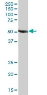 Western Blot: RNF23 Antibody [H00056658-B02P] - Analysis of TRIM39 expression in human kidney.