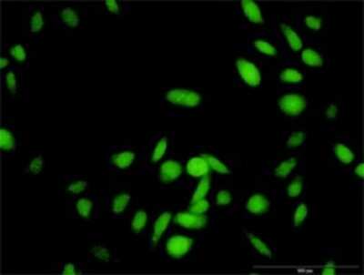 Immunocytochemistry/Immunofluorescence: RNF25 Antibody [H00064320-D01P] - Analysis of antibody to RNF25 on HeLa cell. Antibody concentration 10 ug/ml.