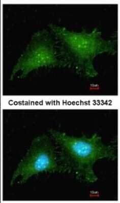 Immunocytochemistry/Immunofluorescence: RNF25 Antibody [NBP1-31491] - Analysis of methanol-fixed HeLa, using antibody at 1:200 dilution.