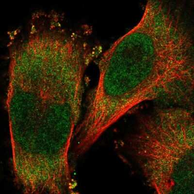Immunocytochemistry/Immunofluorescence: RNF25 Antibody [NBP2-32664] - Immunofluorescent staining of human cell line U-251 MG shows localization to nucleoplasm & cytosol.
