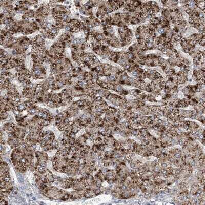 Immunohistochemistry: RNF25 Antibody [NBP2-32664] - Staining of human liver shows strong cytoplasmic positivity in hepatocytes.