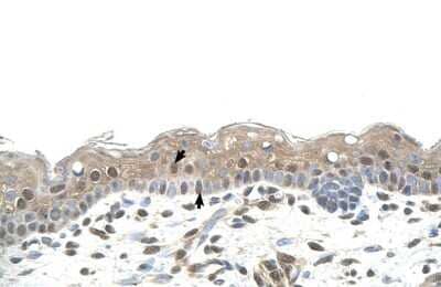 Immunohistochemistry-Paraffin: RNF25 Antibody [NBP1-55063] - Human Skin Tissue Squamous epithelial cells (Indicated with Arrows), 4-8ug/ml.
