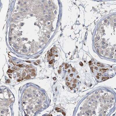 Immunohistochemistry-Paraffin: RNF25 Antibody [NBP1-89069] - Staining of human testis shows cytoplasmic positivity in leydig cells.