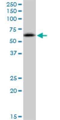 Western Blot: RNF25 Antibody [H00064320-B01P] - RNF25 MaxPab polyclonal antibody. Western Blot analysis of RNF25 expression in HeLa.