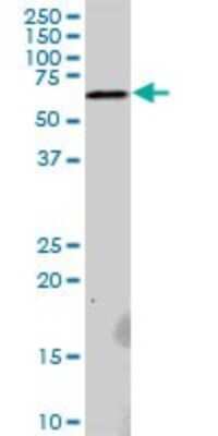Western Blot: RNF25 Antibody [H00064320-B01P] - Analysis of RNF25 expression in Hela S3 NE.
