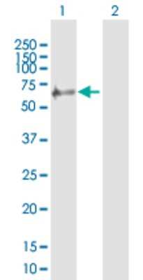 Western Blot: RNF25 Antibody [H00064320-B01P] - Analysis of RNF25 expression in transfected 293T cell line by RNF25 polyclonal antibody.  Lane 1: RNF25 transfected lysate(50.49 KDa). Lane 2: Non-transfected lysate.