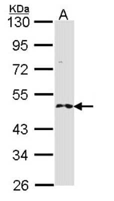 Western Blot: RNF25 Antibody [NBP1-31491] - Sample (30 ug of whole cell lysate) A: H1299 10% SDS PAGE; antibody diluted at 1:1000.