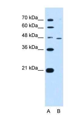 Western Blot: RNF25 Antibody [NBP1-55063] - HepG2 cell lysate, concentration 0.5 ug/ml.