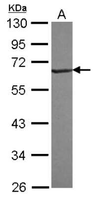 Western Blot: RNF25 Antibody [NBP2-20184] - Sample (30 ug of whole cell lysate) A: Jurkat 10% SDS PAGE gel, diluted at 1:1000.
